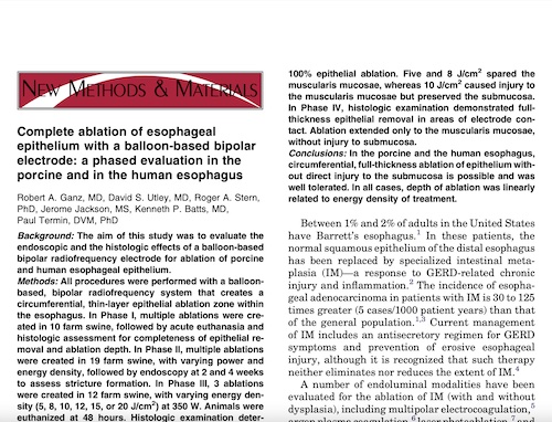 Complete ablation of esophageal epithelium with a balloon-based bipolar electrode